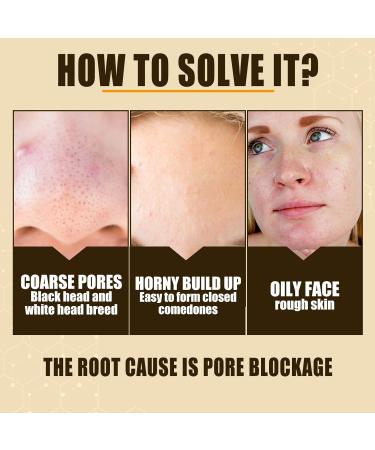 Lactobionic Acid Pore Refining Serum - Minimize Pores Firm Skin & Reduce Fine Lines | Gentle Formula for All Skin Types - International Shipping - Buy Online on GoSupps.com