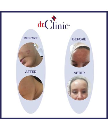 Dr.Clinic Skin Regenerating Spot Cream | Dark Spot Corrector for Age Spots Sun Spots Bikini Area Freckles | Tone Perfecting Cream Remover Face and Body Acne Spot Treatment All Skin Types 50ml. - Buy Online on GoSupps.com