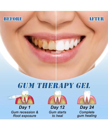 Neslemy Gum Shield Therapy Gel Gum Repair Treatment Gel Dentizen Gum Therapy Gel Teeth Whitening Essence Pen Deeply Cleaning Gums Enhances Overall Gum Health (3pcs) - Buy Online on GoSupps.com
