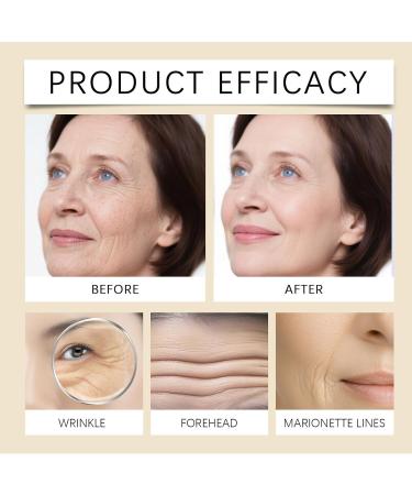  NACGYUDP Roll-on Eye Serum - Reduces dark circles and dull skin around the eyes intensely moisturizes and penetrates quickly refreshes and non-greasy (3 pieces) - Buy Online on GoSupps.com