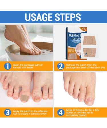 Roser 32 Piece Toenail Correction Patch | Nail Repair & Strengthening for Damaged & Discolored Nails - Buy Online on GoSupps.com