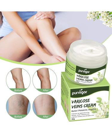 MOMEI Varicose Veins Cream for Legs - Eliminate Varicose & Spider Veins, Improve Circulation, Relieve Pain & Itching - Buy Online on GoSupps.com