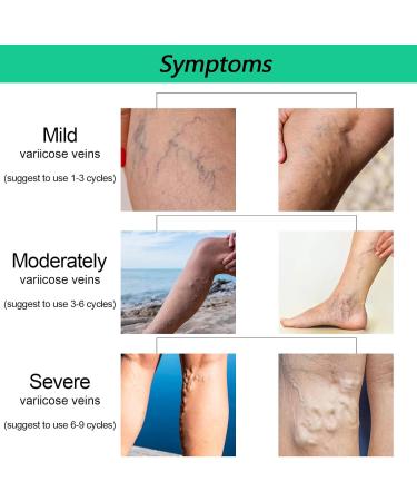  Katutude Veinopro Varicose Veins Treatment Soaps for Legs and All Skin Types (2 Pack) - Buy Online on GoSupps.com