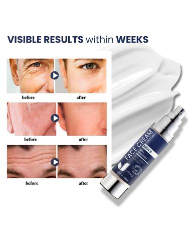 6-in-1 Face Cream for Men: Anti Aging & Wrinkle Cream for Men with Collagen Hyaluronic Acid Vitamins E & B Shea Butter - Dark Spots Remover & Eye Bags Treatment - 1.7 oz. - Buy Online on GoSupps.com
