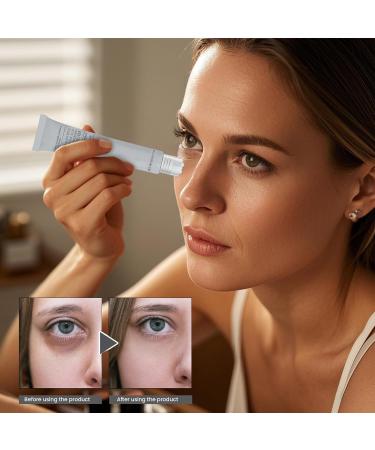  Generisch Eye Cream Roller 20g Concealer for Dark Dark Circles with 360 Spherical Massage Firming and Refreshing Signs of Fatigue and Swelling for Facial Care - Buy Online on GoSupps.com