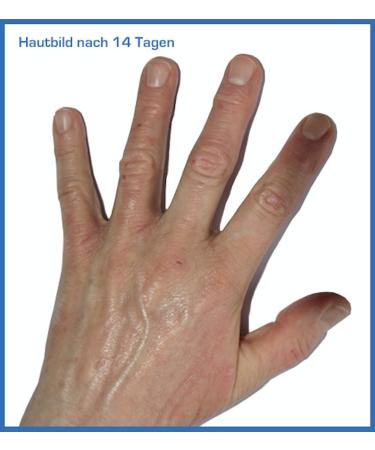 Prontomed SoleaDerm Cream 100ml | Neurodermatitis & Psoriasis Relief | Enriched with Rice Germ Oil & 5% Urea | International Shipping Available - Buy Online on GoSupps.com