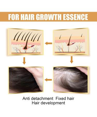 QDHGCFOC Rice Water Hair Oil Hair Serum Natural Rice Essence Nourishing Hair Serum Natural Rice Milk Serum Strengthens Scalp Improves Hair Condition - Buy Online on GoSupps.com