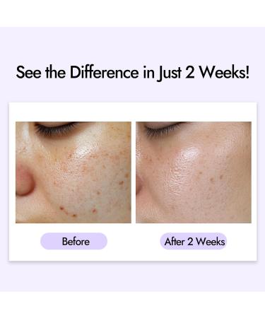 Epielle Balancing Toner Pads 5 Packs Individually Wrapped, Calming & Hydrating Irritated, Sensitive Skin with CICA & Salicylic Acid, Cotton Gauze & Glutathione Jelly, Korean Skin Care (5 Toner Pads) - Buy Online on GoSupps.com