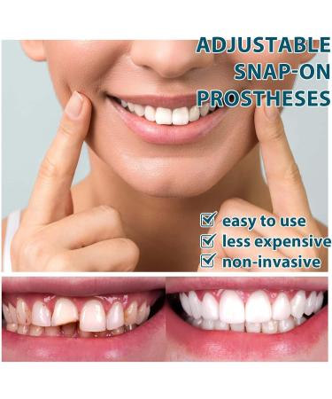 Adjustable Snap-on Dentures | Temporary Teeth Repair Kit for Correct Denture Alignment - Buy Online on GoSupps.com