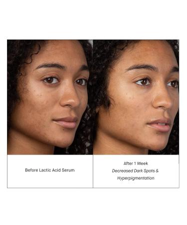 SHANI DARDEN Lactic Acid Face Serum Travel Size - Brightening PM Serum 0.34 fl oz - Buy Online on GoSupps.com