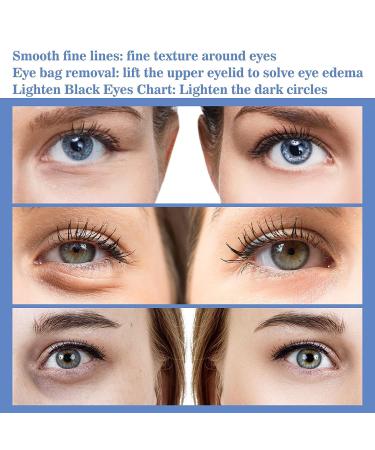 LumiLight VShell Anti-Wrinkle Eye Cream - Snake Venom Peptide Formula (3 PCS) - Buy Online on GoSupps.com