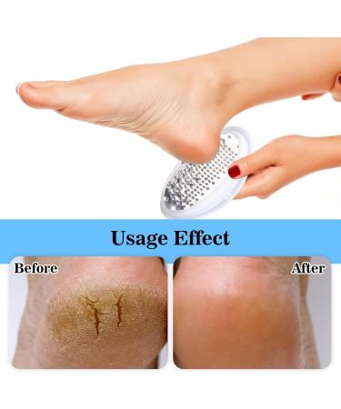 Egg Shape Foot Grinder Manual Callus Remover for Soft Velvety Feet Durable Pedicure Tool Ideal for Dead Skin Removal Eco-Friendly Foot Care Solution for Home Spa and Salon Use Portable and Safe - Buy Online on GoSupps.com
