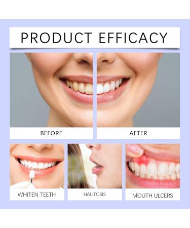 Purple Teeth Cleaning Toothpaste - Gentle Cleaning Fresh Breath Daily Oral Care for Teeth Hygiene(1PCS) 1 Fl Oz (Pack of 1) - Buy Online on GoSupps.com