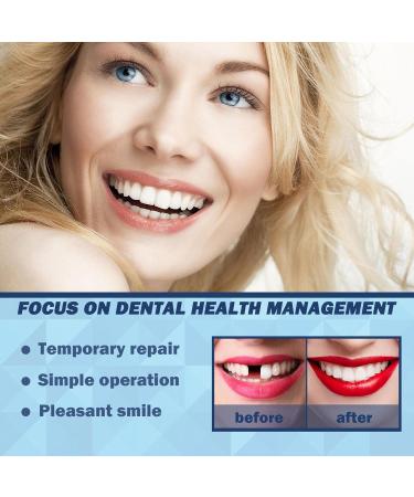 Povanjer Tooth Repair Kit | Missing Teeth Replacement & Gap Filling | Dental Care Tools for Instant Smile Restoration - Buy Online on GoSupps.com