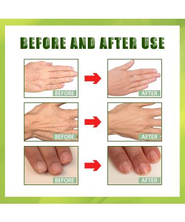 Green Tea Anti-Wrinkle Hand Mask - Hydrating Peel Off Hand Wax for All Skin Types (3 Pieces) - Nourish & Repair Calluses - Buy Online on GoSupps.com