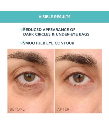 Buy FOREO IRIS Eye Cream - Brightening Dark Circles & Puffiness - Vegan Travel Size 0.5 oz - All Skin Types - Buy Online on GoSupps.com