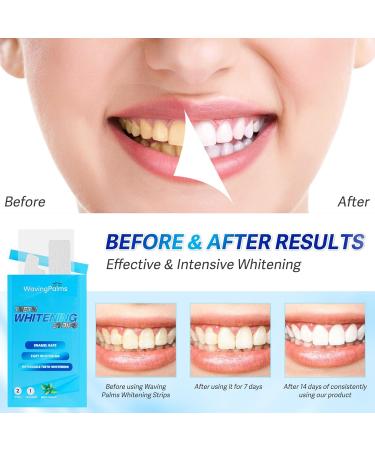 Waving Palms Teeth Whitening Strips - 28 Professional Blue Teeth Whitening Strips for a Bright Smile | Fast International Shipping - Buy Online on GoSupps.com