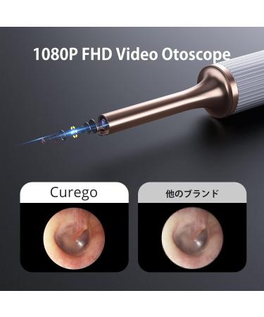 Professional Ear Wax Removal Tool - Safe & Effective | Buy Online - Buy Online on GoSupps.com