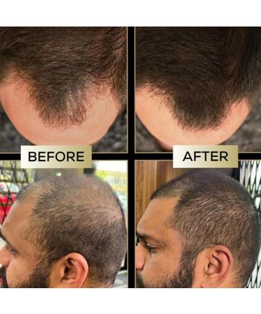 Hair Runner - 50ml balm to improve the hairline | Corrective cream for the | Naturally fuller retaining fibers and to thin the scalp - Buy Online on GoSupps.com