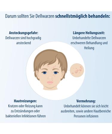 Evolsin Molluscum Warts Agent I For Adults & Children from 2 Years Gentle & Effective Molluscum Warts Treatment - 0.16 Oz - Buy Online on GoSupps.com