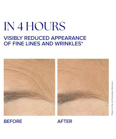IS CLINICAL Youth Complex - Anti-Aging Serum for Collagen Boost & Firm Skin | Ultimate Wrinkle Reducer - International Shipping - Buy Online on GoSupps.com