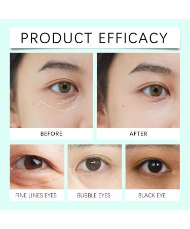 Eye Cream With Centella Asiatica 100g Eye Cream For Dark Circles And Puffy Eyes Repair Cream Eye Cream Anti Aging Eye Tightening Cream Instant Smoothes And Corrects Dark Circles&Eye Bag - Buy Online on GoSupps.com