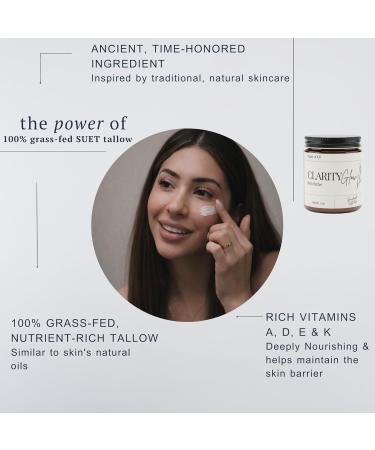 House of A31: CalmGlow Tallow Cream for Face & Body- 100% Grass-Fed Tallow Moisturizer for Sensitive & Acne-Prone Skin | Nurse- Formulated Small Batch- Lavender Vanilla | 2oz - Buy Online on GoSupps.com