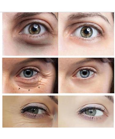 Anti-Wrinkle Firming Eye Contour Oil Anti-Aging Wrinkle-Free Eye Serum Oil Anti-Wrinkle Essence Oil for Dark Circles and Bags Under the Eyes - Buy Online on GoSupps.com