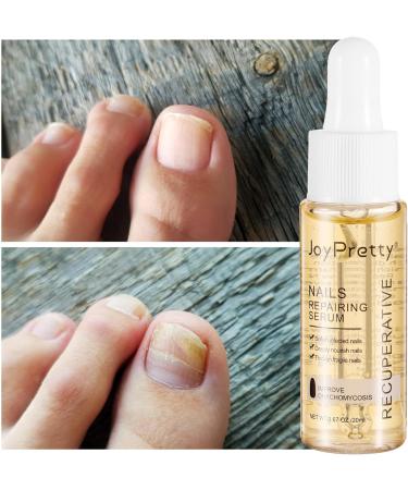 minkissy Nail Repair Serum Nail Repair Liquid for Toenail and Fingernail Nail Repair Solution for Thick Cracked Discolored Nails Restore Healthy Nails - Buy Online on GoSupps.com