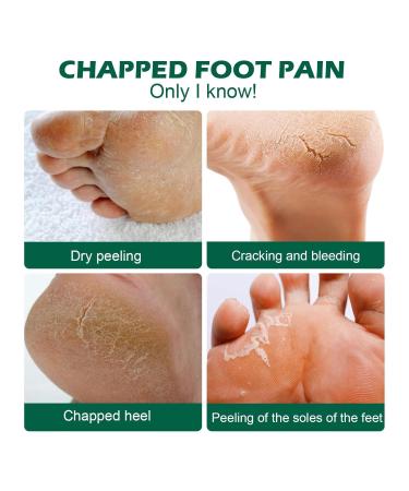 Anti-Dry Cracks & Dead Skin Removal for Hands & Feet | Men's Hygiene Care - Green (1 Pack) - Buy Online on GoSupps.com