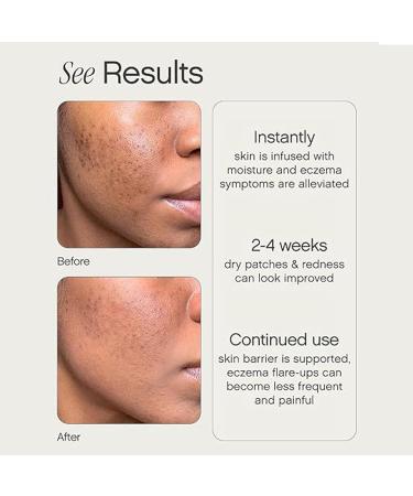 Faded Lightening & Bleaching Serum for Dark Spots & As Moisturizing Butter for Dry & Sensitive Skin (Bundle-50 ml) - Buy Online on GoSupps.com