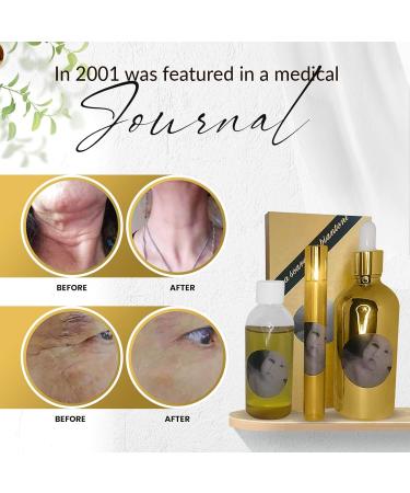 MEGAMOISTURIZER Face & Neck Roll-On Serum - Anti-Aging Fine Line Reduction Skin Tightening - 15ml Facial Serum Applicator - Buy Online on GoSupps.com