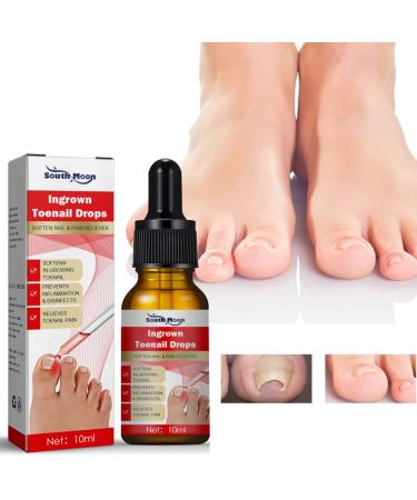 Ingrown Toenail Treatment Nail Helper Nail Growth Treatment Ingrown Toenail Drops Cuticle Nail Oil Ingrown Toenail Correction Fungal Nail Treatment for Toenails Extra Strong for Damaged Nails - Buy Online on GoSupps.com