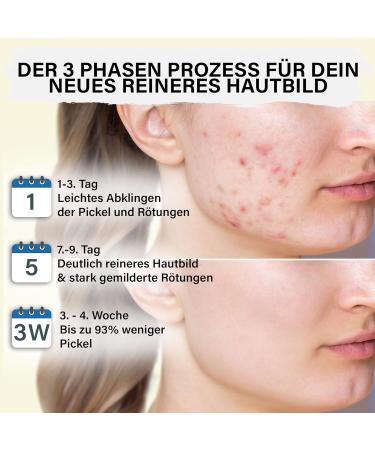 Leafy Zinc Ointment for Pimples | High Dosage with Tea Tree Oil & Salicylic Acid | 50ml Natural Anti-Pimple Cream | Satisa - Buy Online on GoSupps.com
