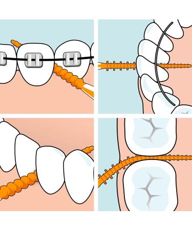 TEPE Easypick Dental Picks - Size M/L (1 x 60 Picks) for Daily Oral Hygiene, Healthy Teeth, and Gums - Buy Online on GoSupps.com