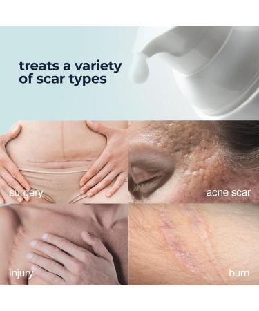 Silicone Scar Cream for Surgical & Bug Bite Scars | All-Natural Acne Scar Treatment with Vitamin E & Retinol - 0.73 Fl Oz - Buy Online on GoSupps.com