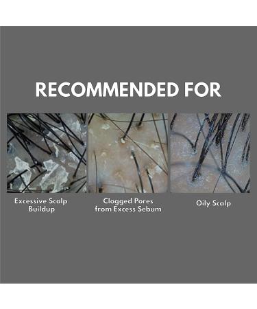 LA DOR Anti-Dandruff Shampoo for Oily Scalp - Soothing 16.9 fl.oz. Formula Cleanses Dead Skin & Alleviates Itching | Buy Internationally - Buy Online on GoSupps.com