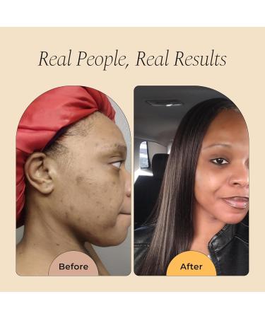 Glo Melanin Rose Glo Oil Natural Brightening & Soothing Facial & Body Oil with Rosehip Sea Buckthorn Argan Grape Seed & Vitamin E 100% Clean Melanin-Friendly (1.7 fl oz 50ml) - Buy Online on GoSupps.com