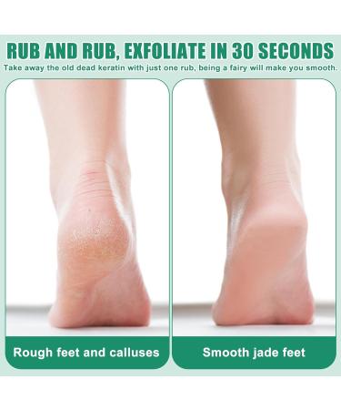 Electric keratinized epidermal removal device electric removal of keratinized epidermis rechargable foot care kit keratinized epidermis 2 - Buy Online on GoSupps.com
