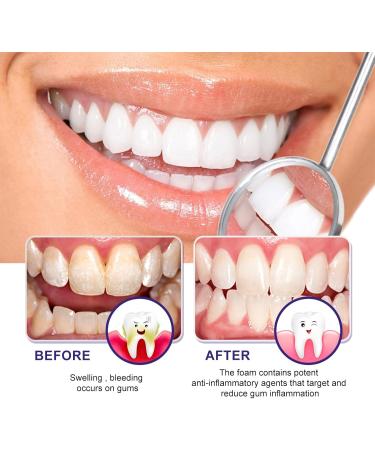 Purple Toothpaste for White Teeth & Gum Repair | Sensitive Tooth Pain Relief | Deep Stain Removal for Coffee & Smoking - Buy Online on GoSupps.com