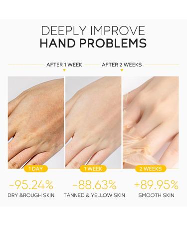 Buy Honey Peel Off Mask & Deep Moisturizing Hand Wax - Hydrating Exfoliating Mask for Women | Nourishing & Brightening Serum for Dry Skin - Buy Online on GoSupps.com