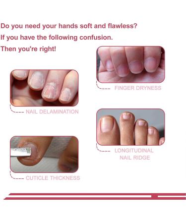 Saluaqui Nail Cuticle Care Kit Strengthens Weak Nails Trimming Tool Included Cuticle Remover Kit Safe Ingredients Easy to Use for Nourishing and Hydrating for DIY Nail LS152-3 - Buy Online on GoSupps.com