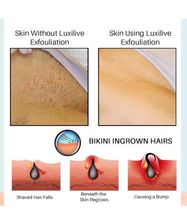 Hair Inhibitor 100ml Roll-on Serum for Ingrown Hair & Razor Bumps | After Shave Repair Solution for Men & Women | Skin Lightening for Bikini Area, Legs & Underarms - Buy Online on GoSupps.com