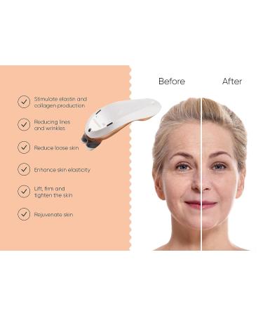 Sensilift Radio Frequency Skin Tightening Device - Anti-Aging Kit for Smooth, Rejuvenated Skin | Reduce Wrinkles, Crow's Feet, and Tighten Jawline | Includes Base Gel for Effective Results - Buy Online on GoSupps.com