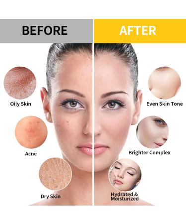 Nielies Vampire & Chamomile Patel Jelly Mask Set for Instant Hydration & Anti-Aging - Buy Online on GoSupps.com