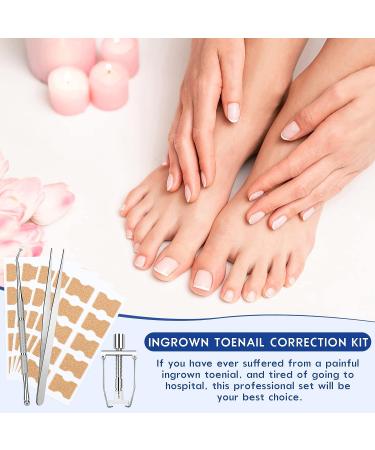 Professional Ingrown Toenail Treatment Kit - Includes Toenail Corrector, Tweezer, Strips, Braces, and Patches - Buy Online on GoSupps.com