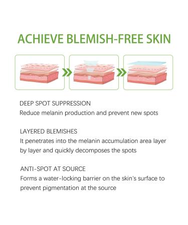 G neric Crema Para Manchas Oscuras En La Cara 30ml Crema Para Las Manchas De La Cara 1pcs Para Piel Entrepierna Manchas Codos Piernas Zonas Rodillas Cuello - Buy Online on GoSupps.com