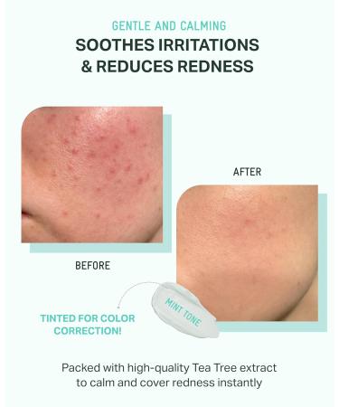 BRING GREEN Tea Tree CICA Mineral Sunscreen SPF 50+ PA++++ | Non-Nano Zinc Oxide Face Sun Lotion Reef Safe Korean Sunscreen for Sensitive Skin Oil-Free 1.69 fl. oz - Buy Online on GoSupps.com