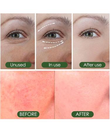 Nettoyant Visage For Un Nettoyage En Profondeur Un Teint clatant Et Des Pores Resserr s - Soin R parateur Hydratant For Lutter Contre Le Teint Terne - Buy Online on GoSupps.com