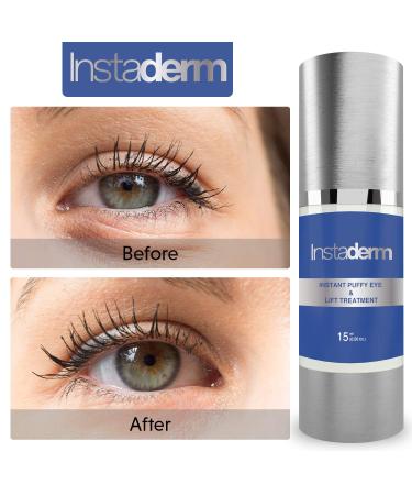 Puffy Eye & Lift Treatment: Eliminate Bags, Dark Circles & Wrinkles Instantly - Buy Online on GoSupps.com